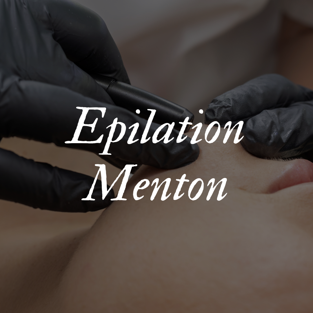 Epilation Menton